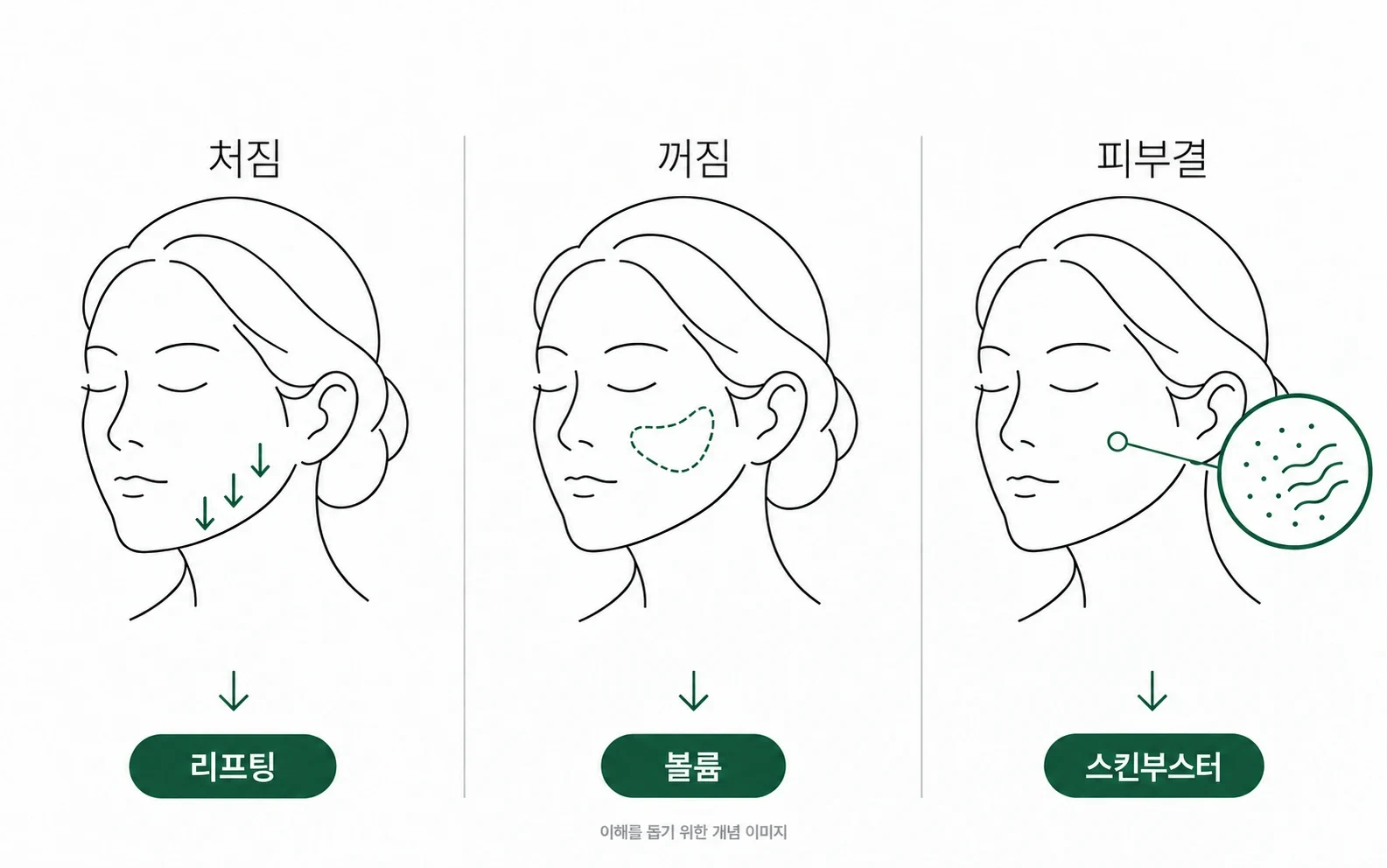 노화 세 갈래와 맡는 시술 — 처짐은 리프팅, 꺼짐은 볼륨, 피부결은 스킨부스터