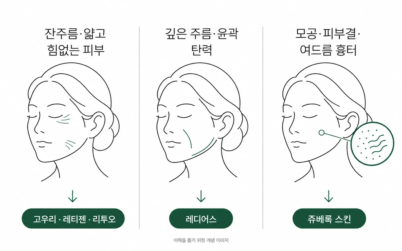 피부 고민별 스킨·콜라겐 부스터 — 잔주름·얇고 힘없는 피부는 고우리·레티젠·리투오, 깊은 주름·윤곽 탄력은 레디어스, 모공·피부결·여드름 흉터는 쥬베룩 스킨